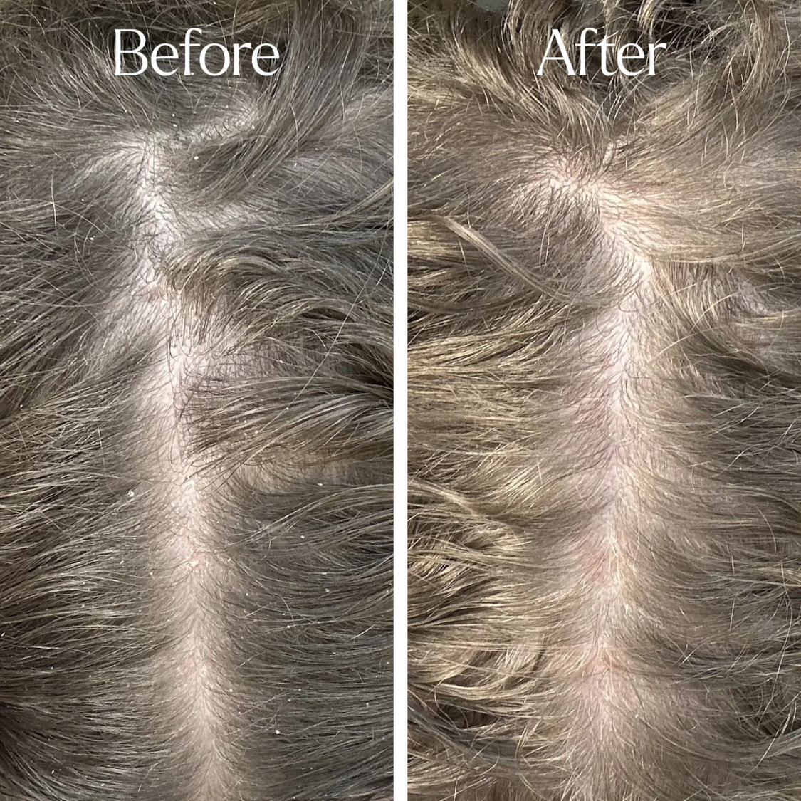 Only Curls | Curl Detox Clarifying Shampoo /200ml Tiefenreinigungsshampoo Only Curls